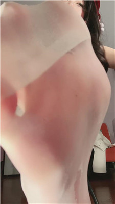 【佳佳】早些治疗+开发    241224-3  第10张